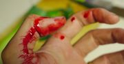 Potworna tragedia na prywatnej posesji. 40-latka nadziała się na żeliwny płot!