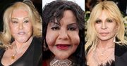 Te gwiazdy ZMASAKROWAŁY sobie twarz operacjami plastycznymi: Donatella Versace, Linda Evangelista, Jocelyn Wildenstein i inni