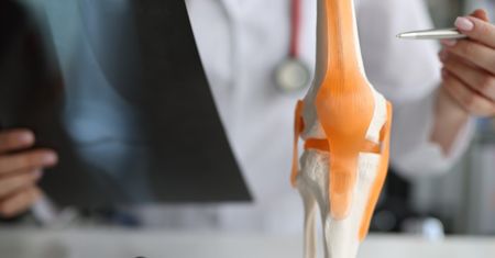 Osteoliza – przyczyny, objawy, diagnostyka i leczenie