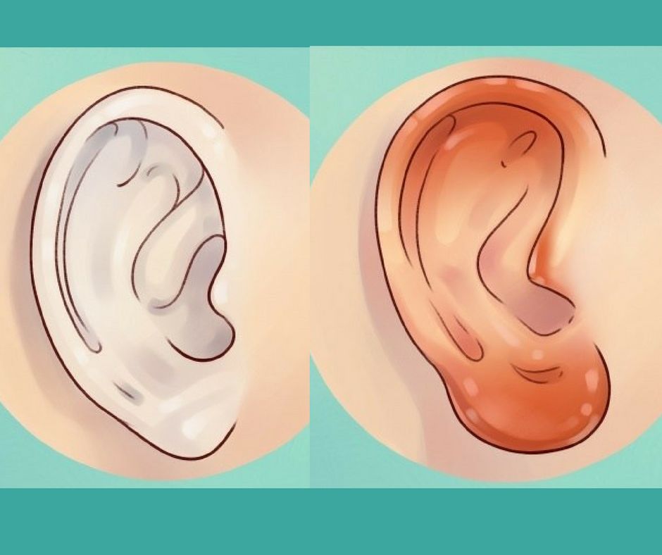 Kolor uszu a zdrowie