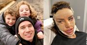 Były mąż Katie Price martwi się, że po nowych operacjach będzie STRASZYĆ DZIECI: "Nie jest to PRZYJEMNY OBRAZ"