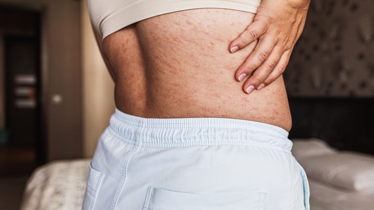 Tego tłuszczu się nie pozbywaj. Gwarantuje długie życie 