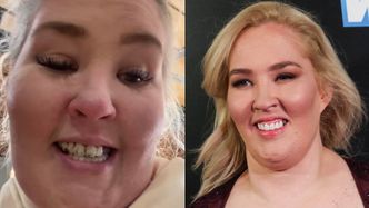 Mama June twierdziła, że wydała 150 TYSIĘCY ZŁOTYCH na licówki. Pokazała, jak po latach wyglądają jej zęby (FOTO)