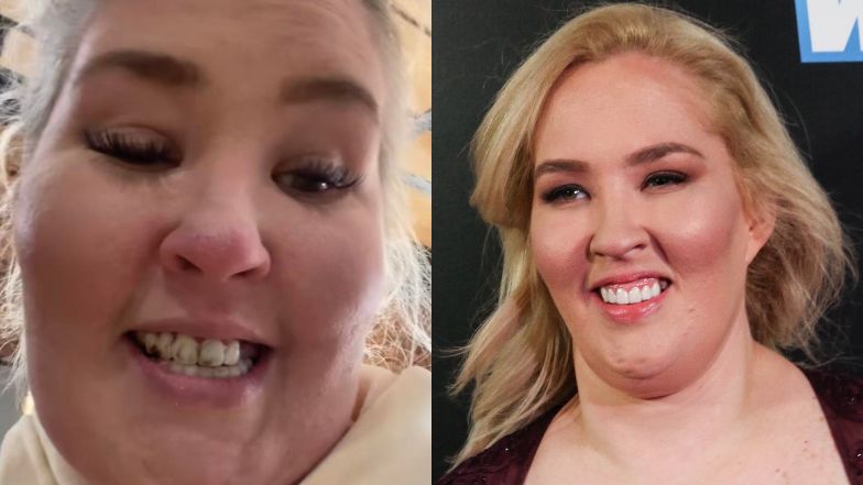 Mama June twierdziła, że wydała 150 TYSIĘCY ZŁOTYCH na licówki. Pokazała, jak po latach wyglądają jej zęby (FOTO)