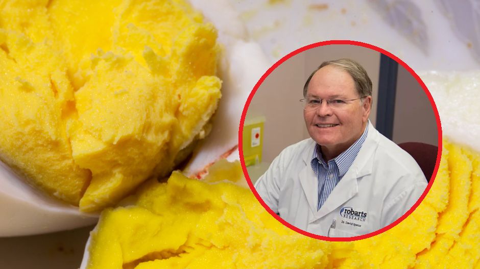 Żółtka mogą zwiększać ryzyko udaru