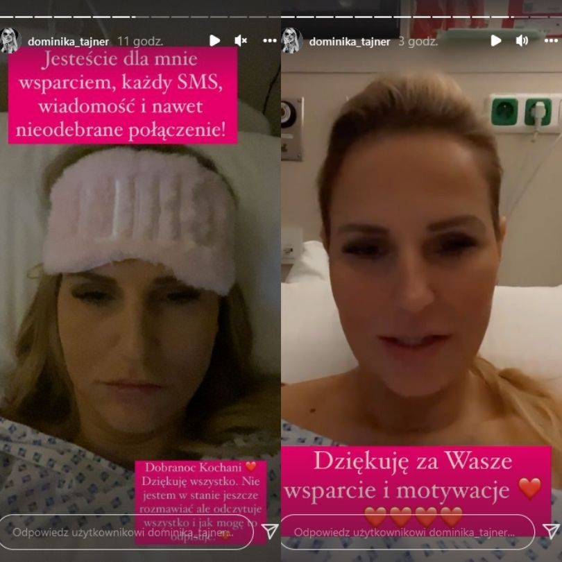 Dominika Tajner poddała się operacji rekonstrukcji piersi