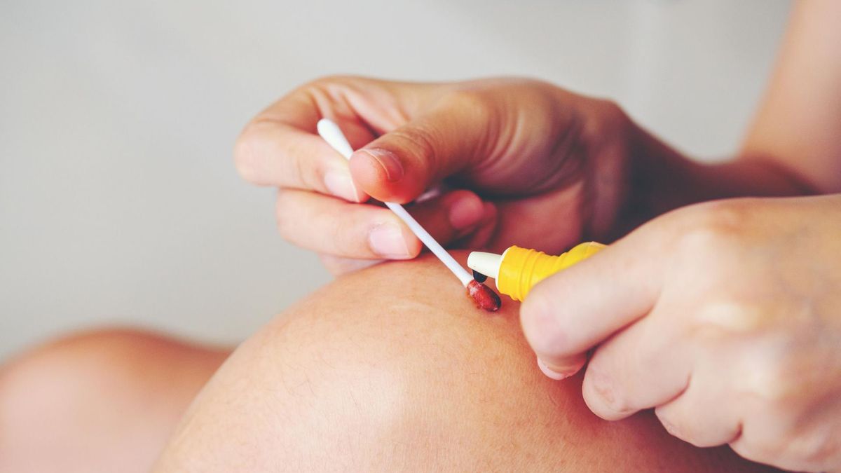 Jodyna to popularny środek dezynfekujący. 