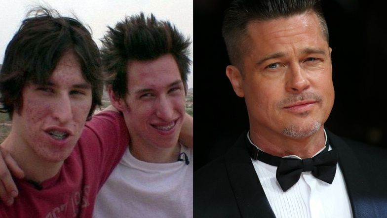 The twins underwent surgery to look like Brad Pitt.