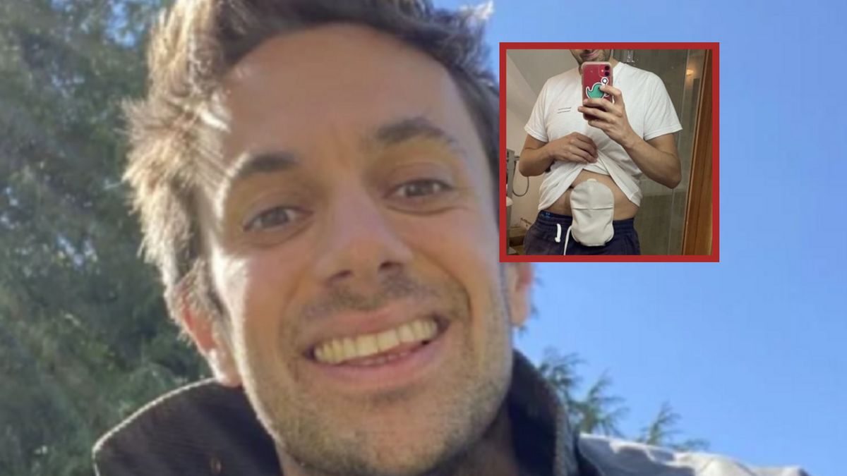 33-latek opowiada o walce z rakiem jelita grubego. Nie wierzył, że w tak młodym wieku może zachorować