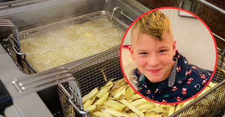 Gorący olej poparzył mu ciało. 13-letni Kuba walczy o życie