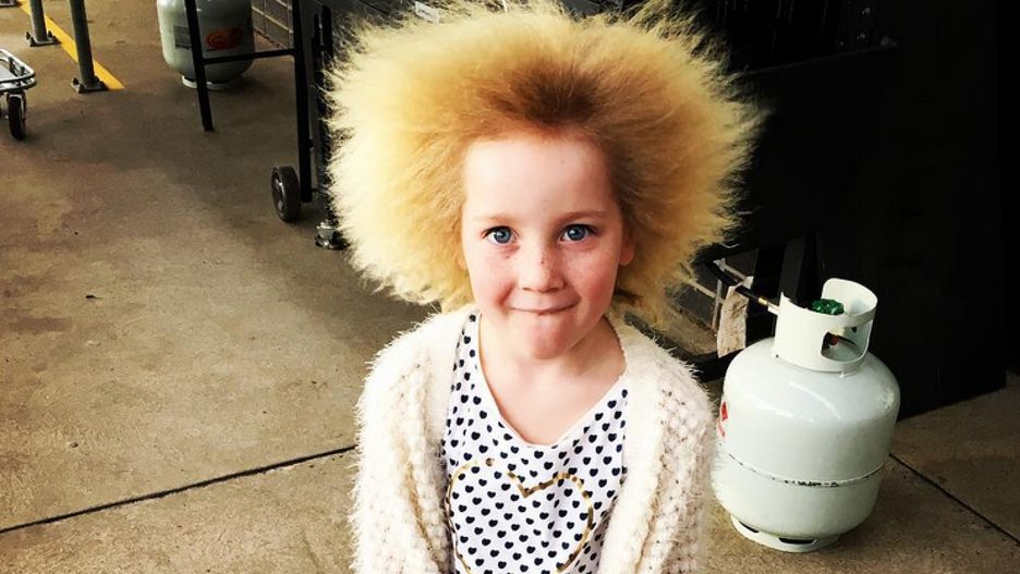 Cierpi na "syndrom nieuczesanych włosów". Dziś ma 14 lat i tak wygląda