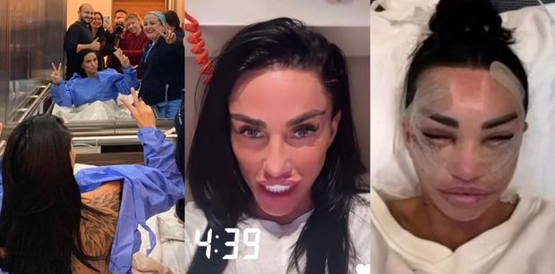 U Katie Price bez zmian. Pokazała twarz całą w opatrunkach, relacjonując kolejną operację w tureckiej klinice