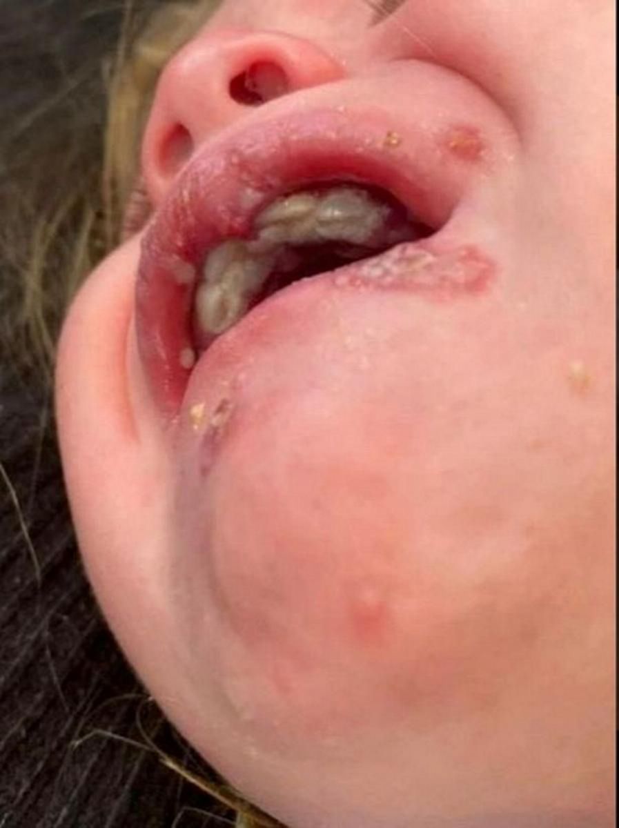 Jej córka została pocałowana w usta