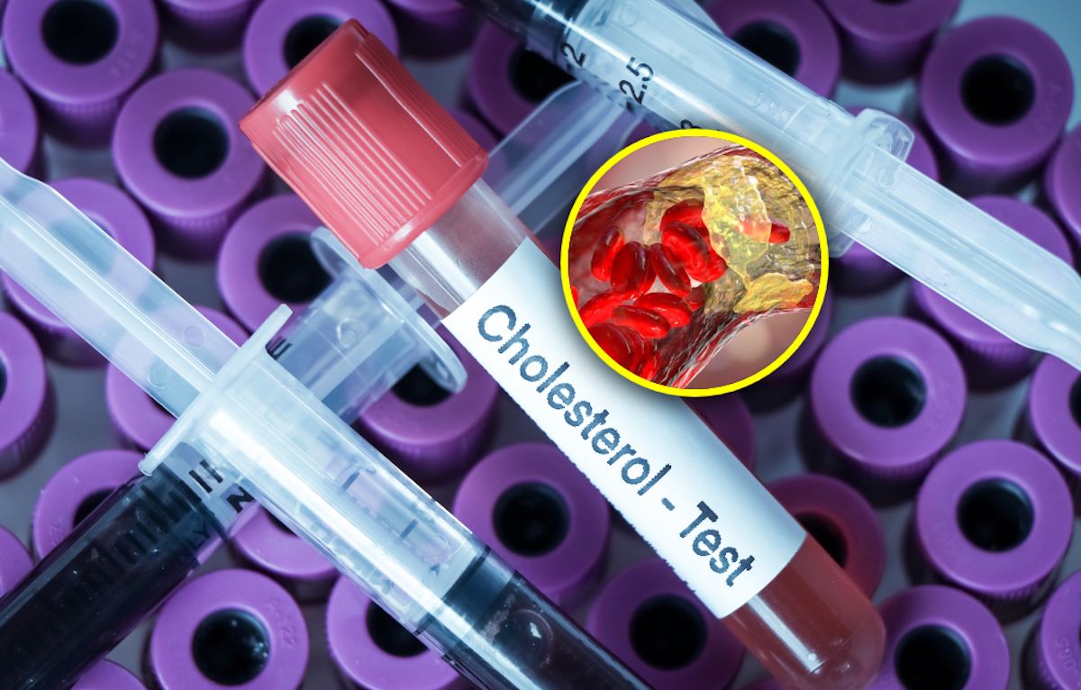 Jak najszybciej zbadaj cholesterol. Zawał serca u osób w coraz młodszym wieku