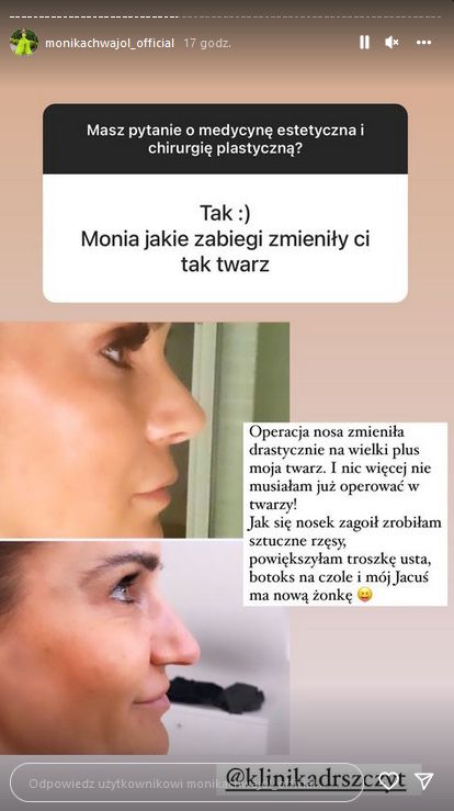 Monika Chwajoł pokazała stare zdjęcia i opowiedziała o operacjach