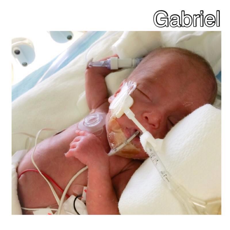 Rodzice udostępniali zdjęcia małego Gabriela z prośbą o modlitwę