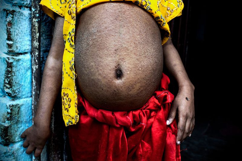 Alex Masi - Bhopal: 30 Years of Tragedy 5