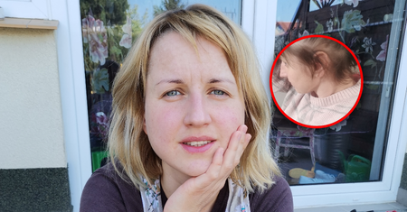 Laura od 27 lat wyrywa sobie włosy z głowy. "W akcie rozpaczy ogoliłam się na łyso"