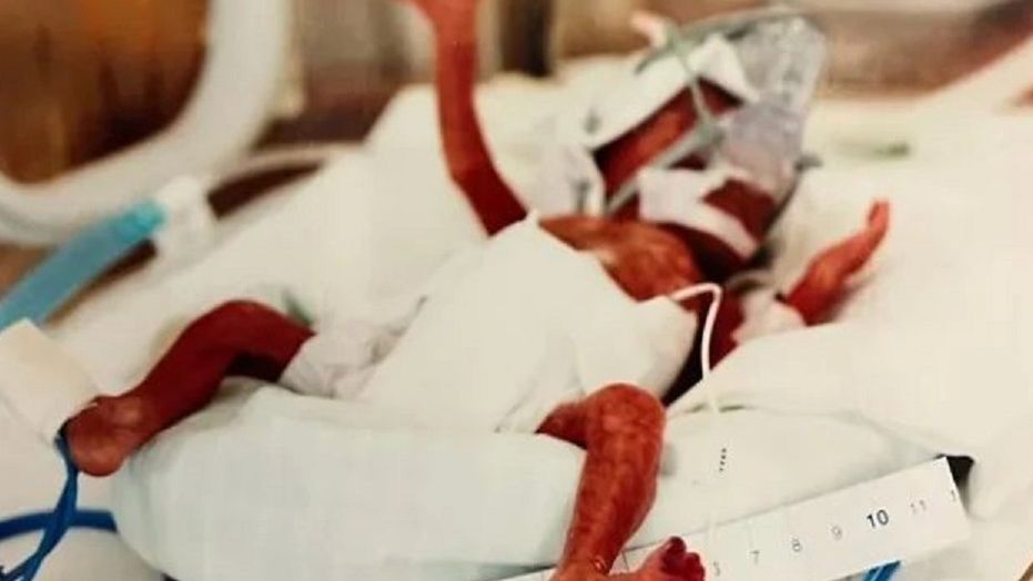 Jedno z najmniejszych dzieci w Polsce wkrótce skończy 10 lat. "Ważyła 570 g"