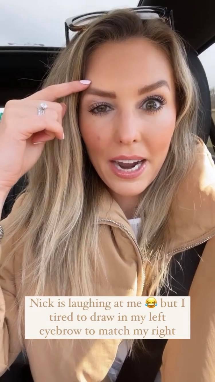 Whitney Buha po nieudanym botoksie