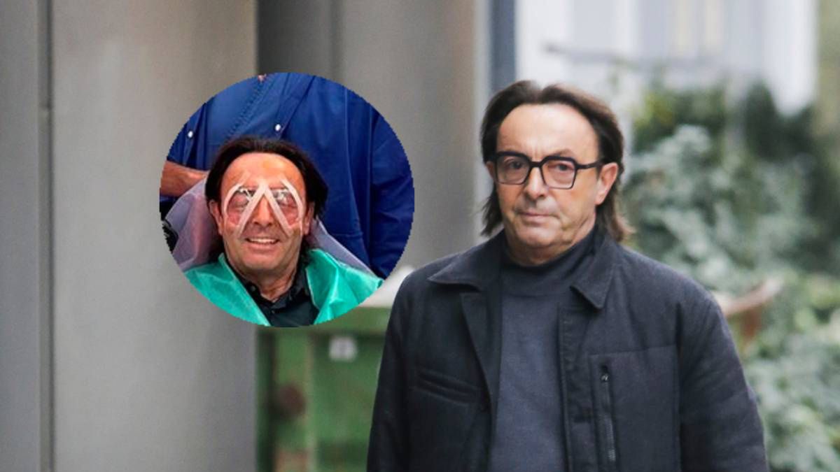 Michel Moran musiał przejść zabieg