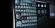 Rehabilitacja z ZUS w schorzeniach neurologicznych