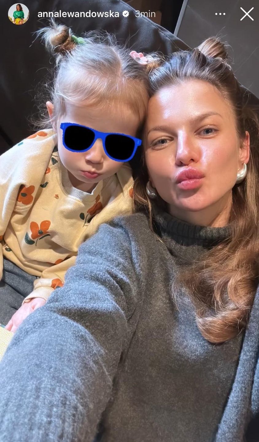 Anna Lewandowska bez makijażu 