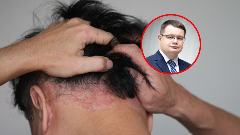 Skóra głowy pod lupą.