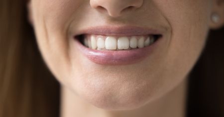 Dr Smile z zarzutami UOKiK. "Wywieranie presji i manipulowanie"