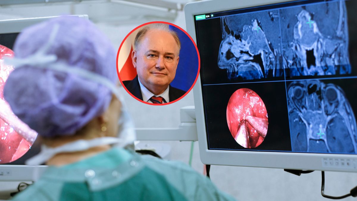 Zdj. eksperta: Umed.pl