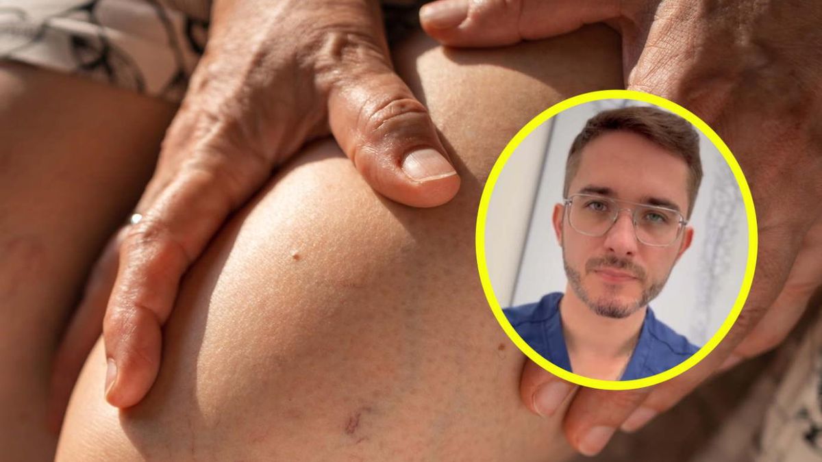 Flebolog ostrzega. "Alarmującym objawem jest obrzęk jednej kończyny"