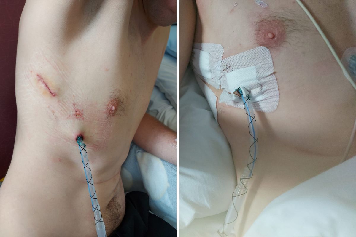 31-latek postanowił swoją historią podzielić się w mediach społecznościowych. Opublikował też zdjęcia