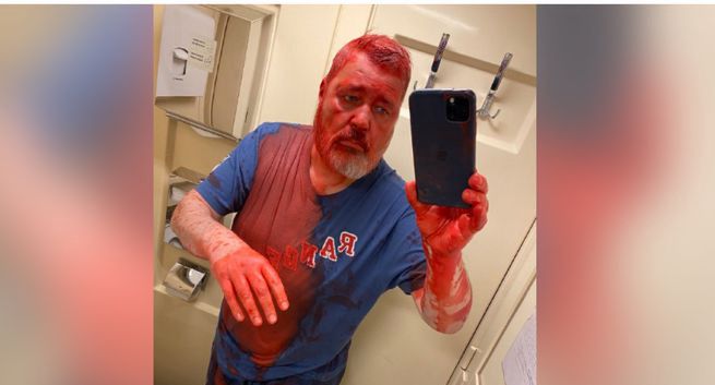 Za atakiem na Dmitrija Muratowa stoją służby Rosji