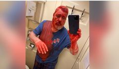 Za atakiem na Dmitrija Muratowa stoją służby Rosji