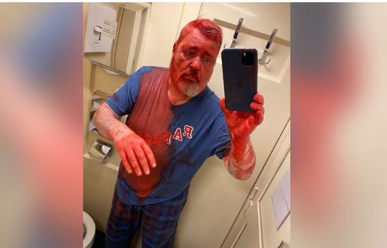 Za atakiem na Dmitrija Muratowa stoją służby Rosji