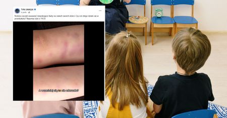 Dzieci wracały z przedszkola z siniakami. Iwona D. usłyszała zarzuty