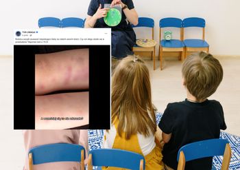 Dzieci wracały z przedszkola z siniakami. Iwona D. usłyszała zarzuty