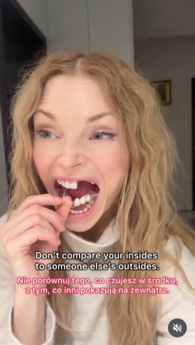 Izabella Miko