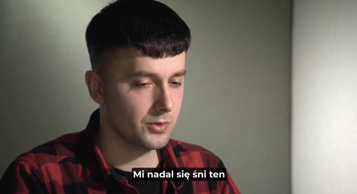 Poddali się przeszczepowi włosów w polecanej klinice