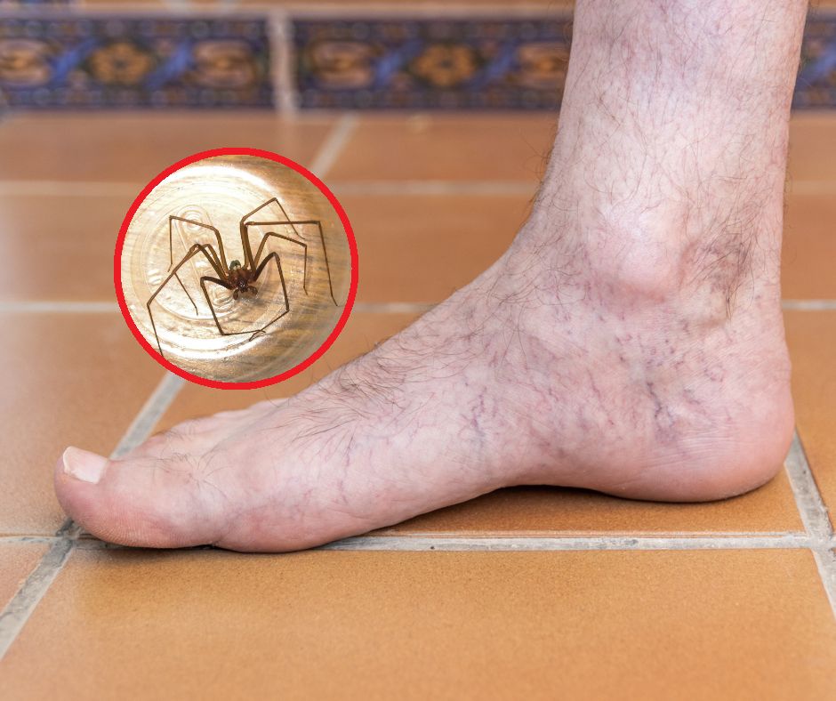 Lekarze byli wstrząśnięci. Pierwsze takie powikłanie po ukąszeniu przez pająka