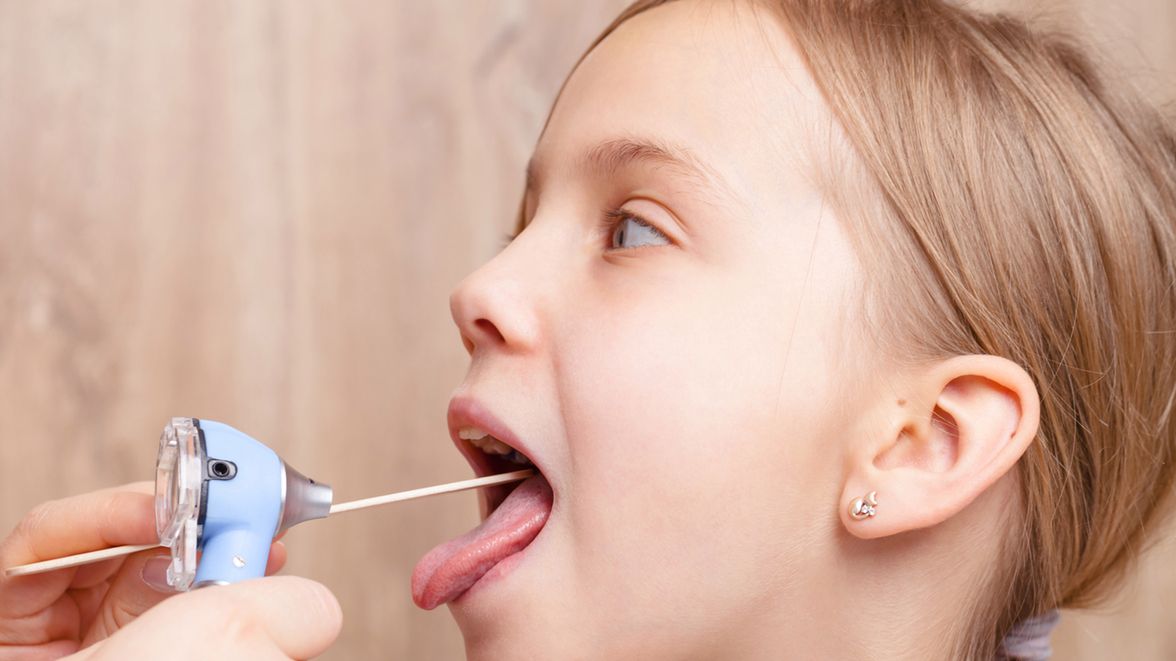 Na zapalenie gardła najczęściej chorują dzieci w wieku 4-7 lat, zwłaszcza te uczęszczające do przedszkoli.