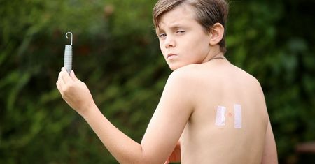 Sprężyna z trampoliny wbiła mu się w plecy. 12-latek trafił do szpitala