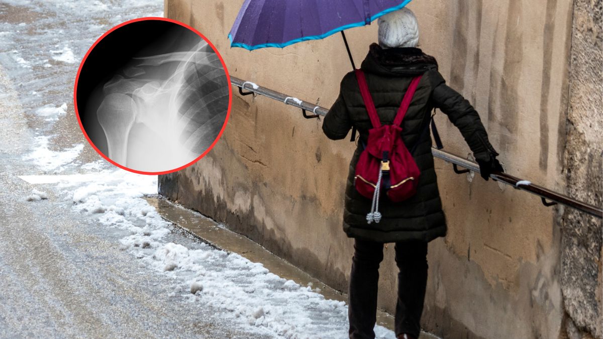 Zima obnaża słabości kości