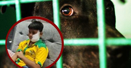 Atak pitbulla na dziecko. Potrzebnych było 150 szwów