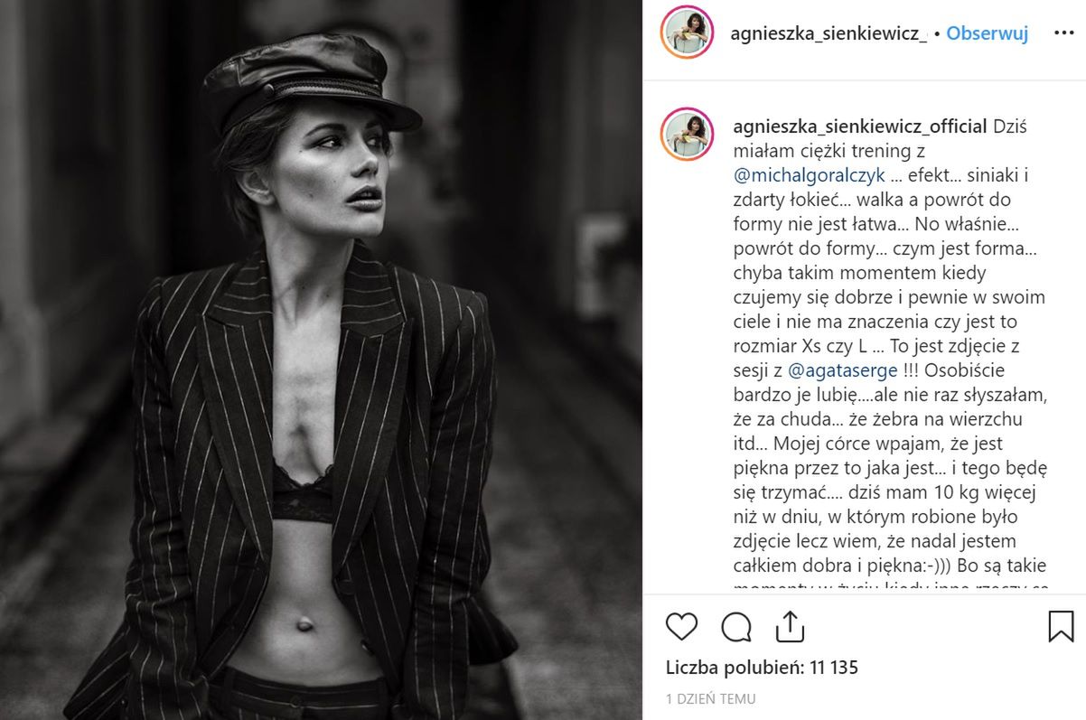 Agnieszka Sienkiewicz pokazała jak wyglądała przed ciążą.