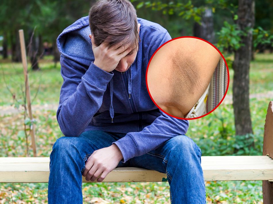 Cukrzyca, rak, PCOS. Polacy bagatelizują ten groźny objaw na skórze