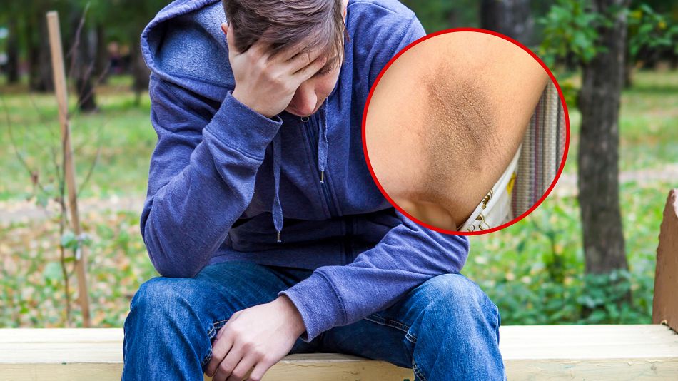 Ciemne plamy na skórze pod pachami mogą być objawem nowotworu