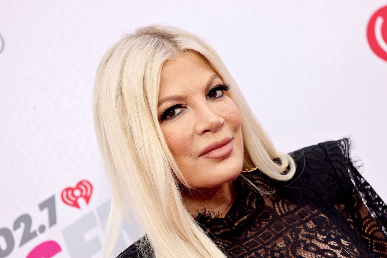 Tori Spelling ma problemy z okiem