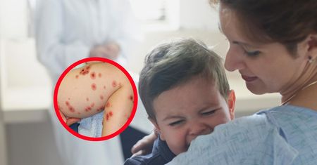 Na skórze 2-latka pojawiły się swędzące plamy. Tak objawiał się LABD