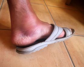 Objawy chłoniaka. Na co warto zwrócić uwagę?